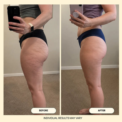 ELIKS Anti-Cellulite Massage Oil