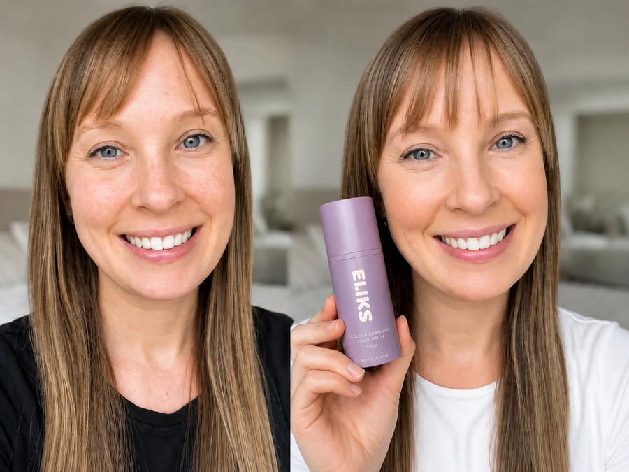 Denise M. Before / After