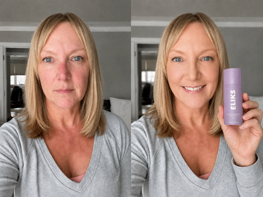 Karen B. Before / After